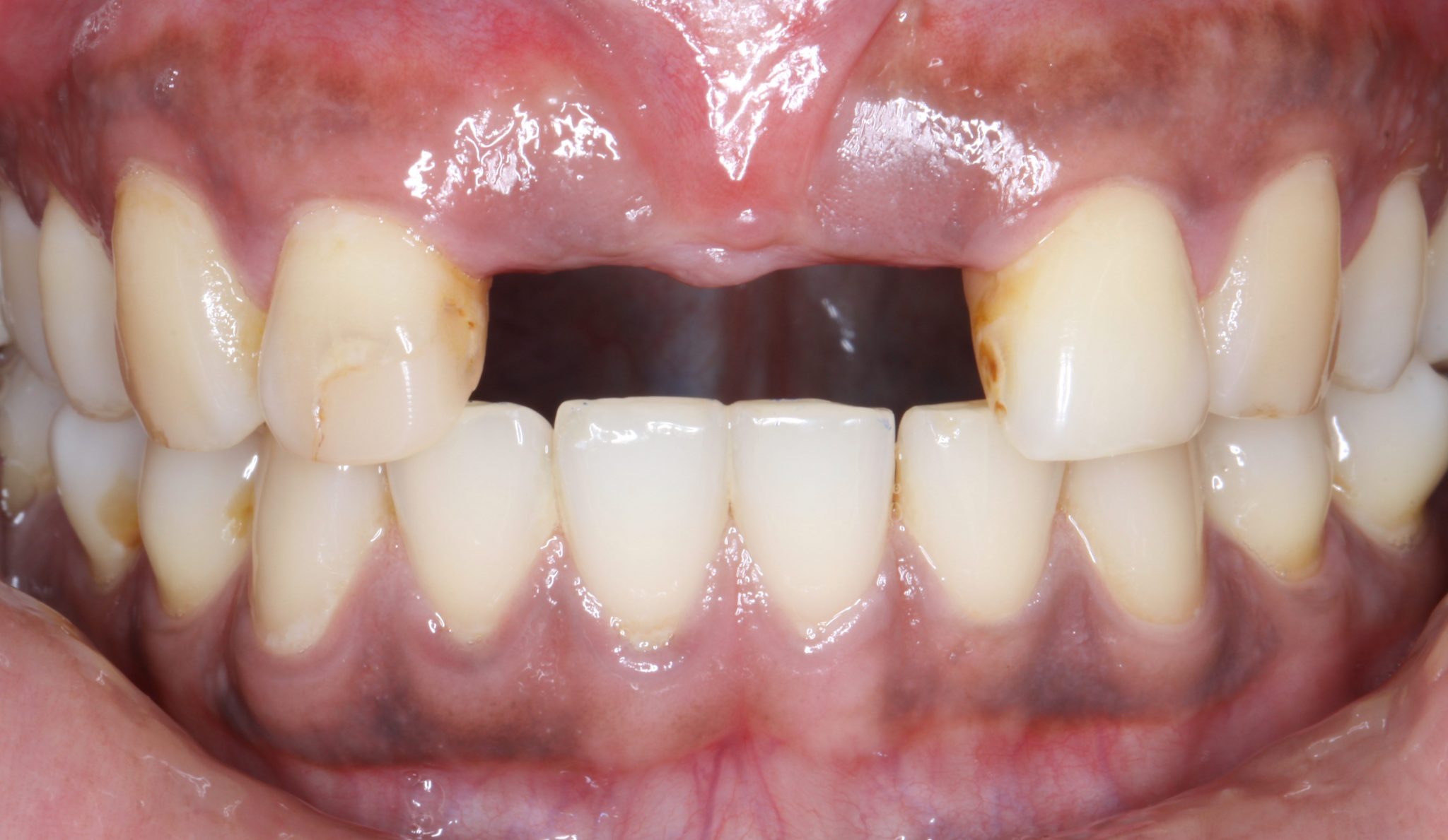 What is the Fiji Dental & Medical Foundation? Namotu Island Fiji