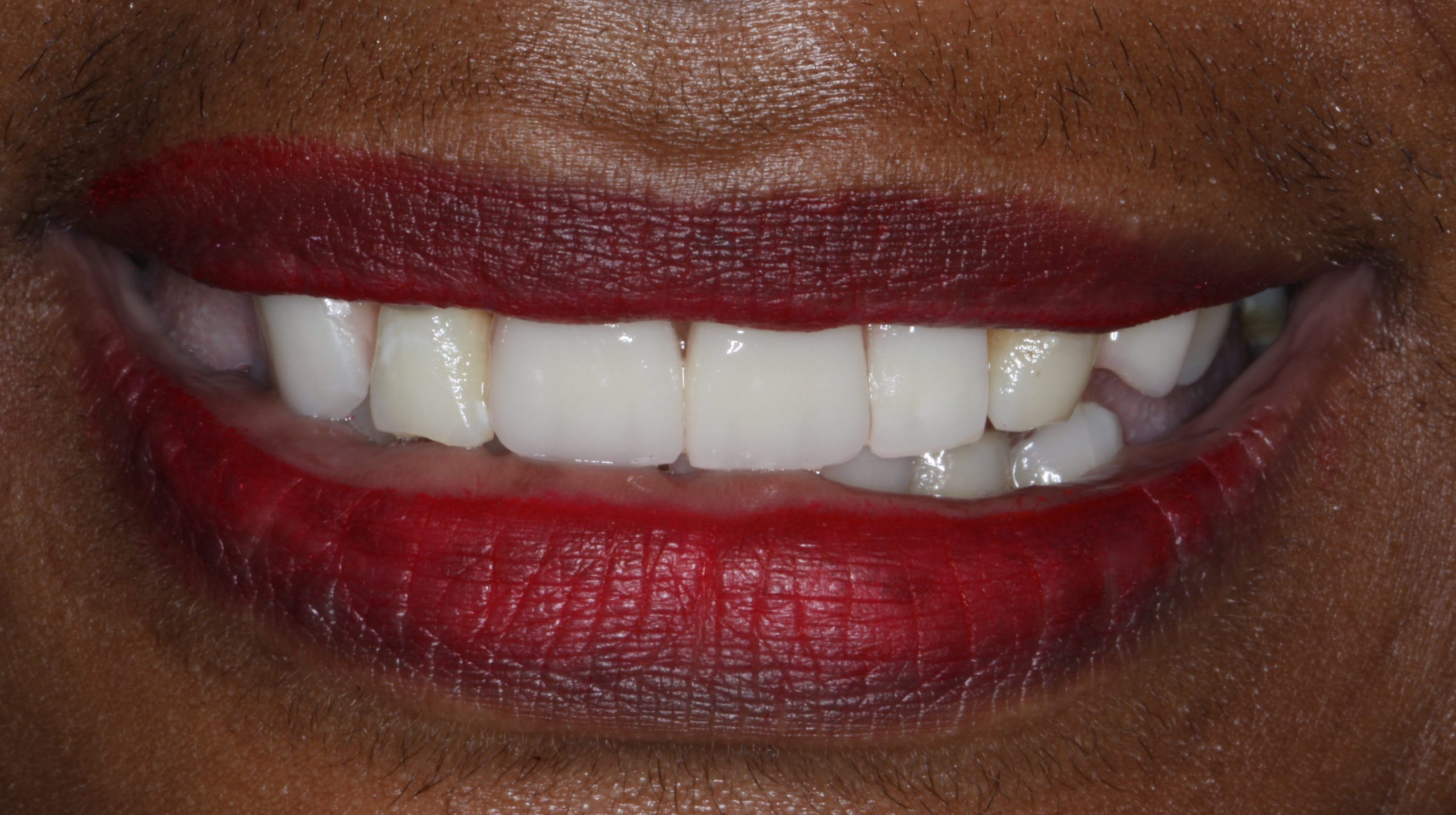 What is the Fiji Dental & Medical Foundation? Namotu Island Fiji