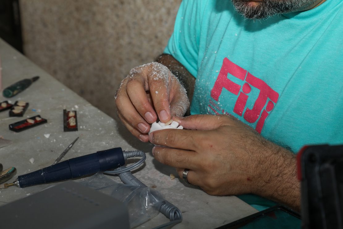 Charles making false teeth at the clinic